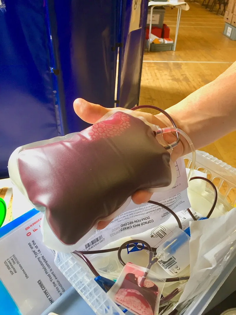 The Real Reason Your Doctor Says No Coffee Before a Blood Test Has Nothing to Do With Caffeine