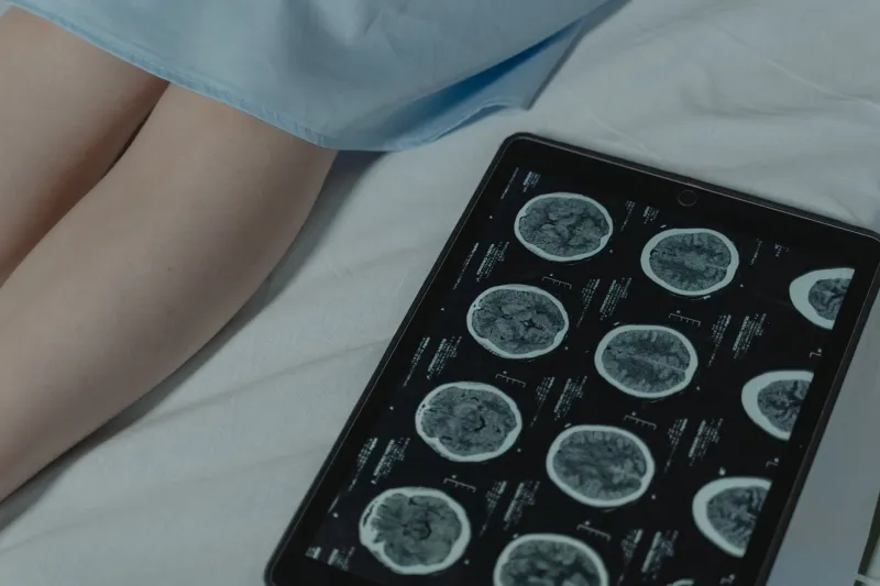Neuroscience Killed the '10% of Your Brain' Myth Decades Ago — So Why Won't It Die?